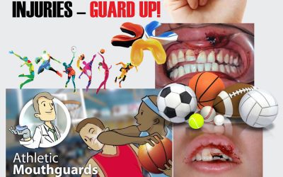 Knocked-Out Tooth – What if a tooth gets knocked out in an accident?