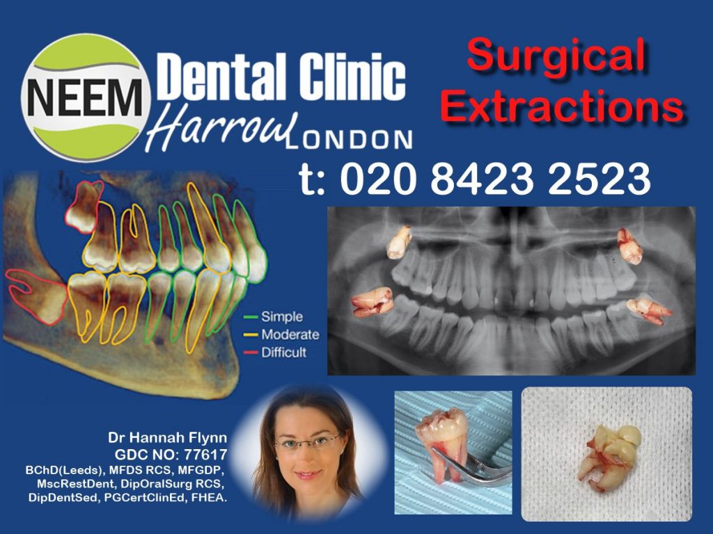 Extractions / Oral Surgery In Neem Dental Clinic - Harrow , London