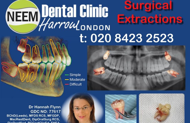 Extractions / Oral Surgery In Neem Dental Clinic - Harrow , London