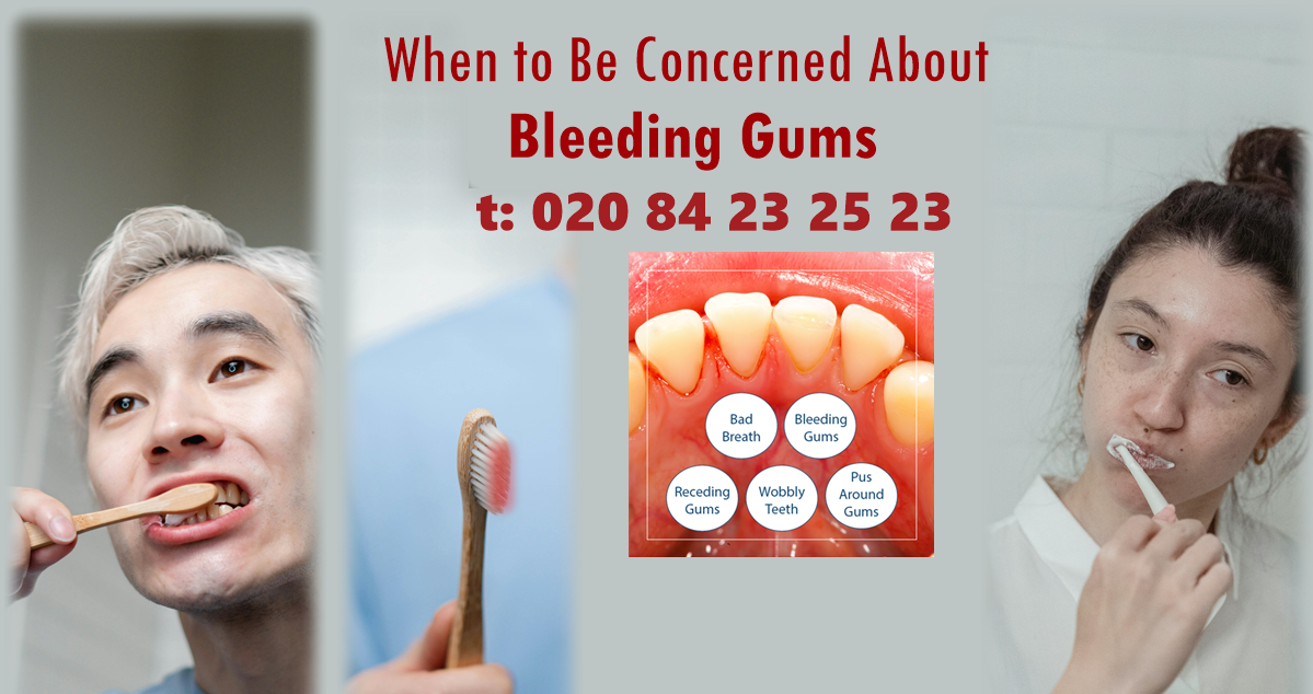Bleeding Gums Tratment in Harrow, London banner Stop Bleeding Gums and Protect Your Smile