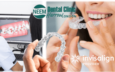 Invisalign London | Harrow No. 1 Provider of Invisalign Braces