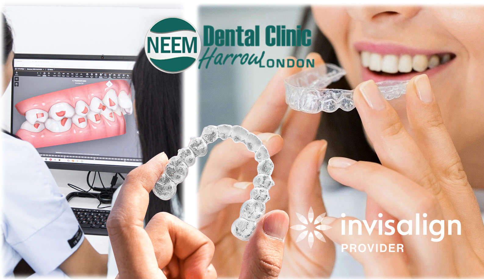 Harrow top Invisalign provider